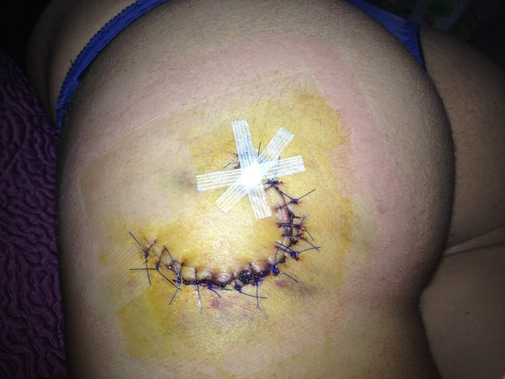 ouch!.jpg